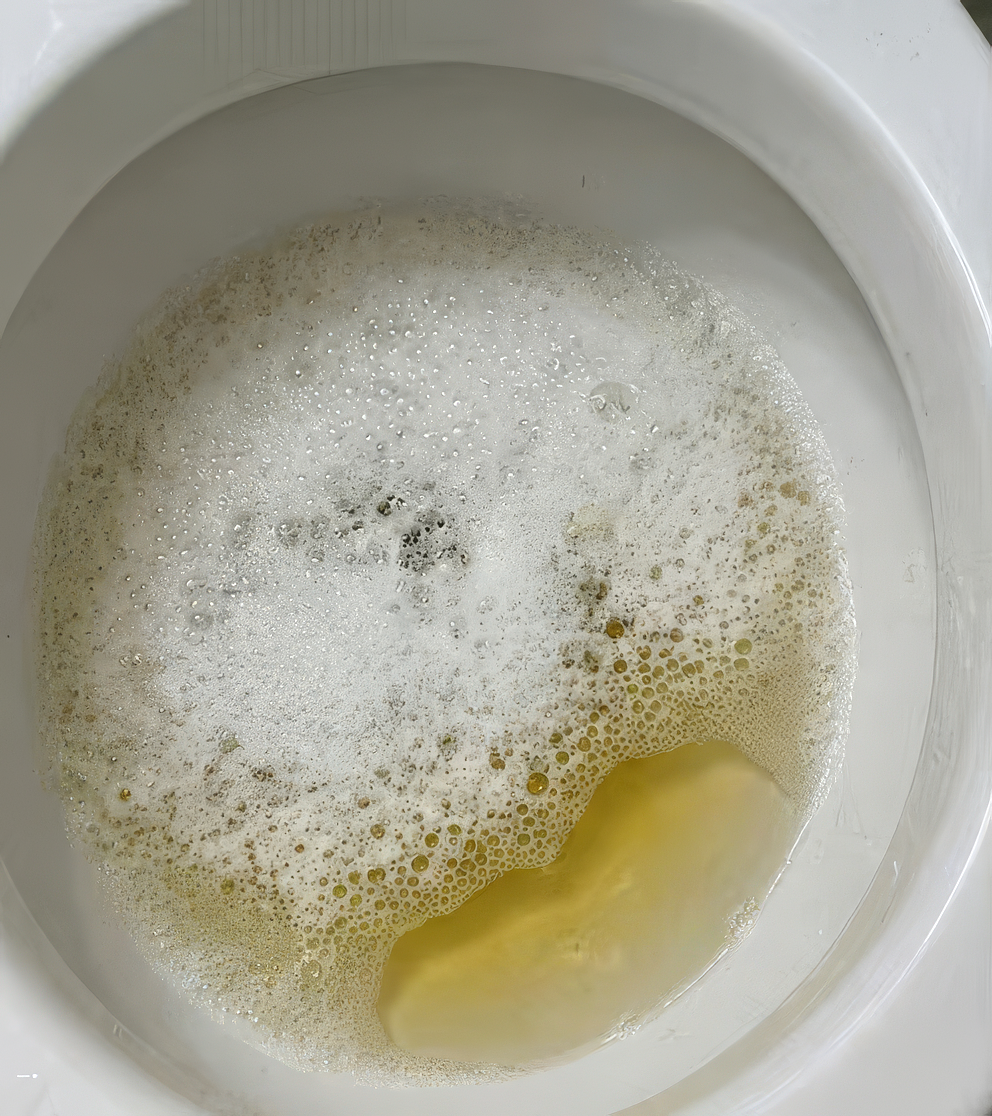 Antes: incomodidad y urgencia al usar el baño